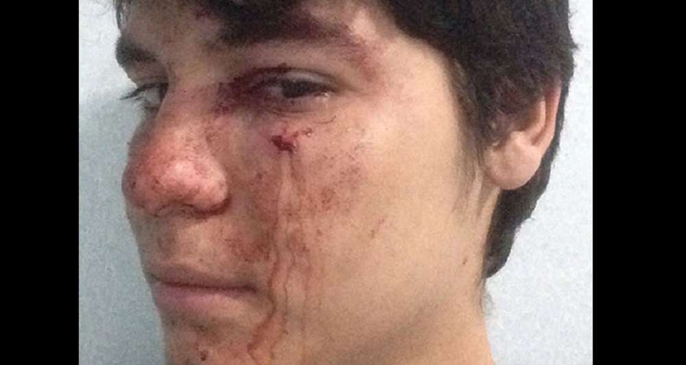 [Video] Policías de tránsito le pegaron un puño en la cara a joven que se negó a entregarles su motocicleta