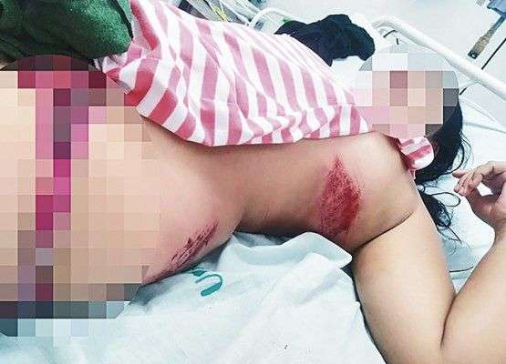 Mujer resultó herida tras ser arrollada por el conductor de una lancha en Coveñas