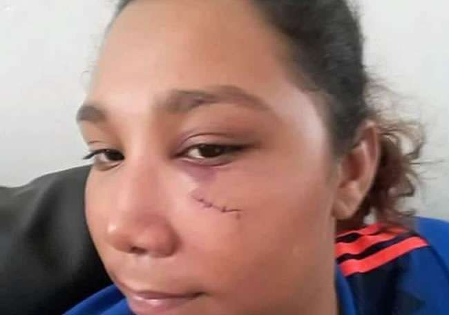 En plena vía pública joven de 20 años fue golpeada por su exmarido