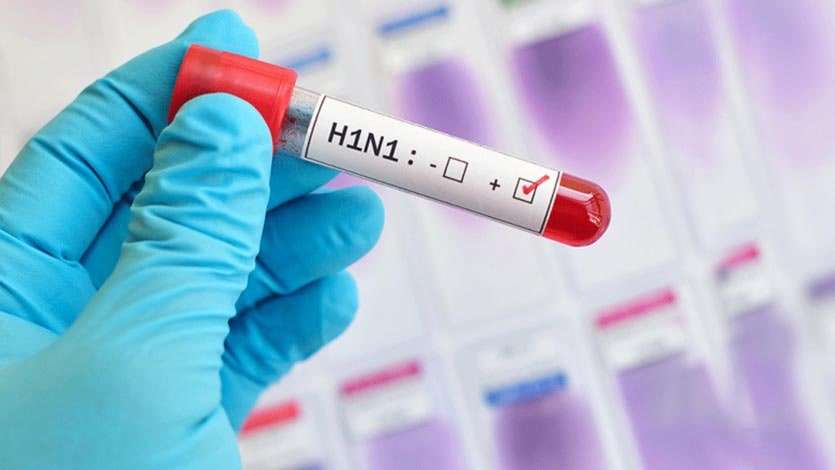 ¡Alerta! Confirman 10 casos de influenza H1N1 en Córdoba