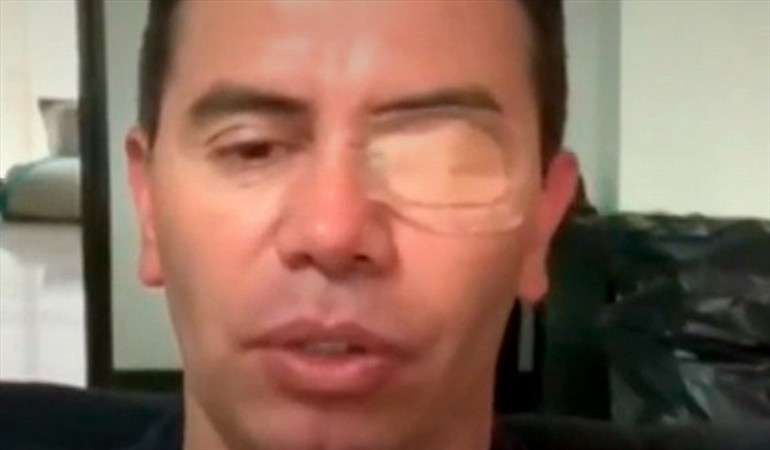 El cantante Jhonny Rivera casi pierde un ojo tras resultar herido con pólvora