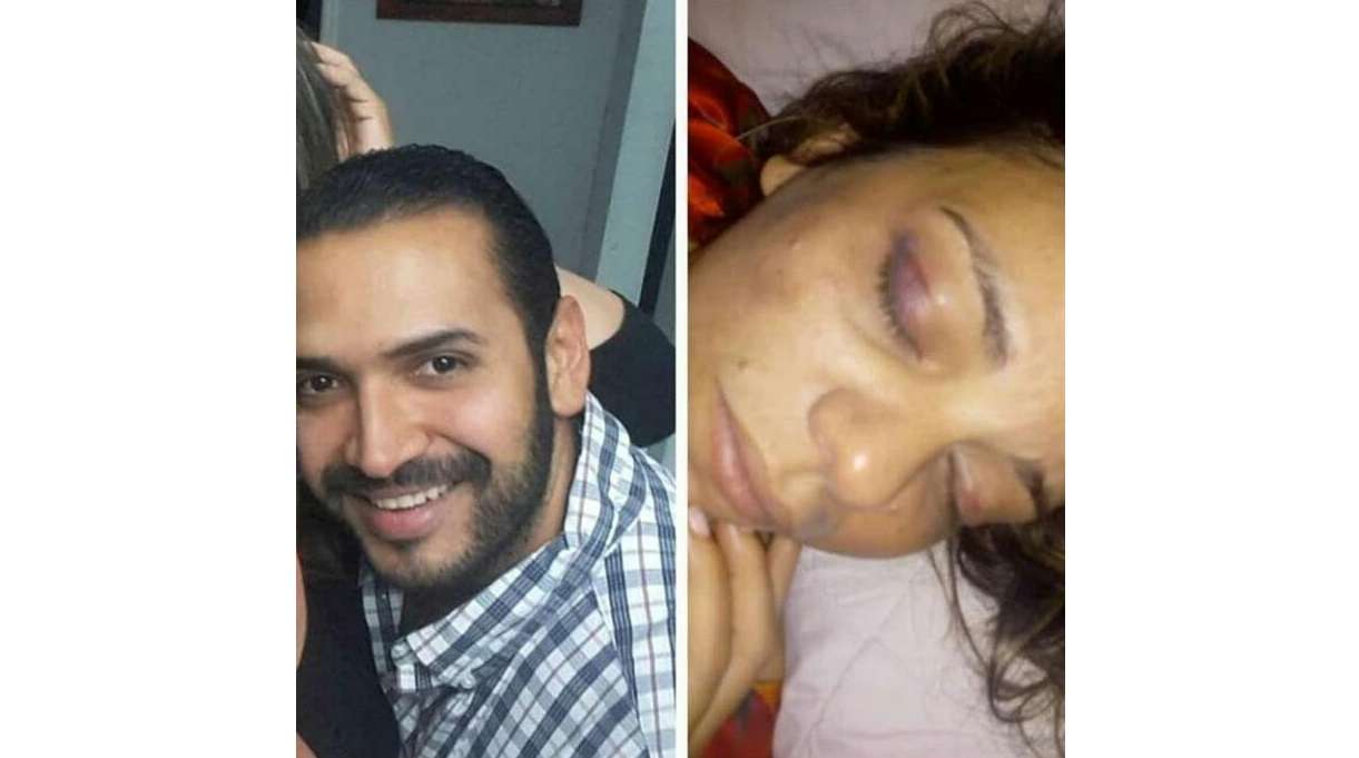 Casi la mata a golpes: Carlos agredió brutalmente a su novia por un ataque de celos