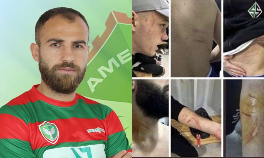 [VIDEO] Qué mala leche, futbolista turco es acusado de herir a rivales con una cuchilla en pleno partido