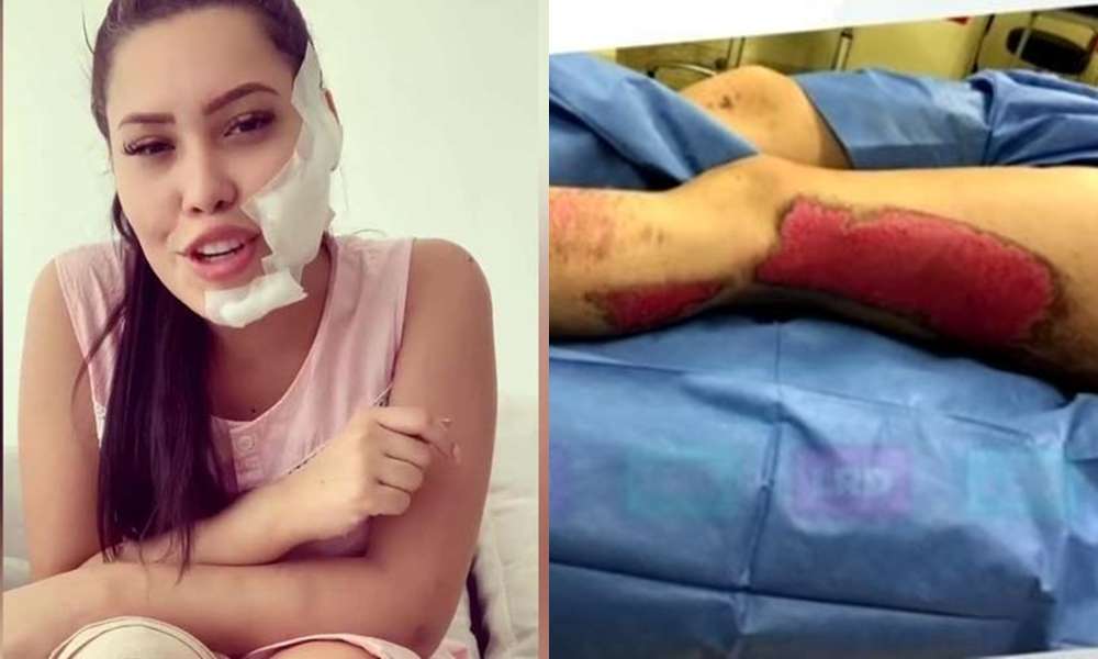 Impactante, Así quedó Ana Del Castillo después del accidente