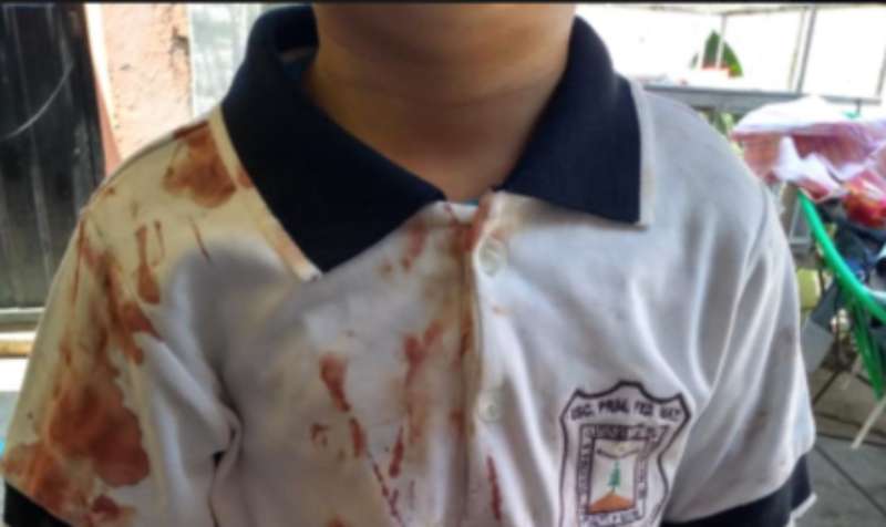 ¿Qué haría usted si su hijo llega del colegio con la camisa ensangrentada? Madre denuncia caso de bullying