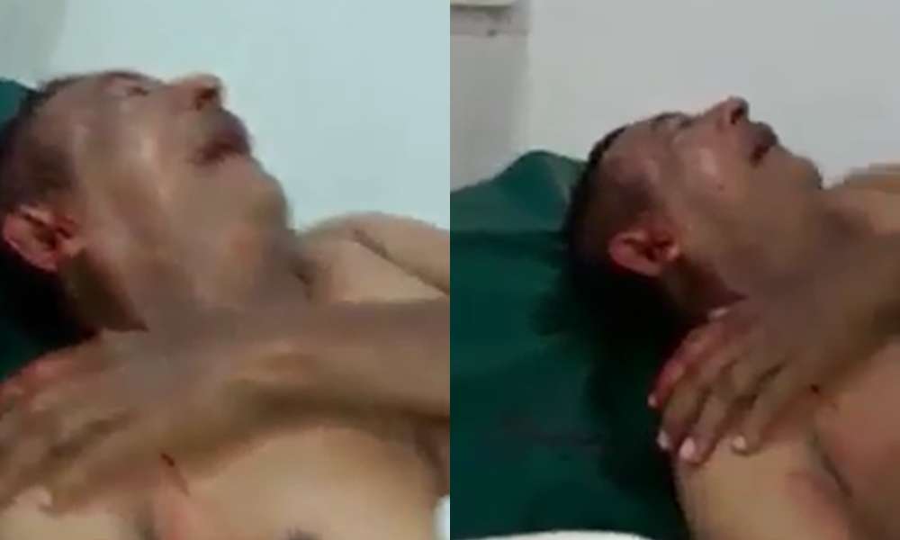 Con un taco de billar golpean brutalmente a operario de Uniaguas
