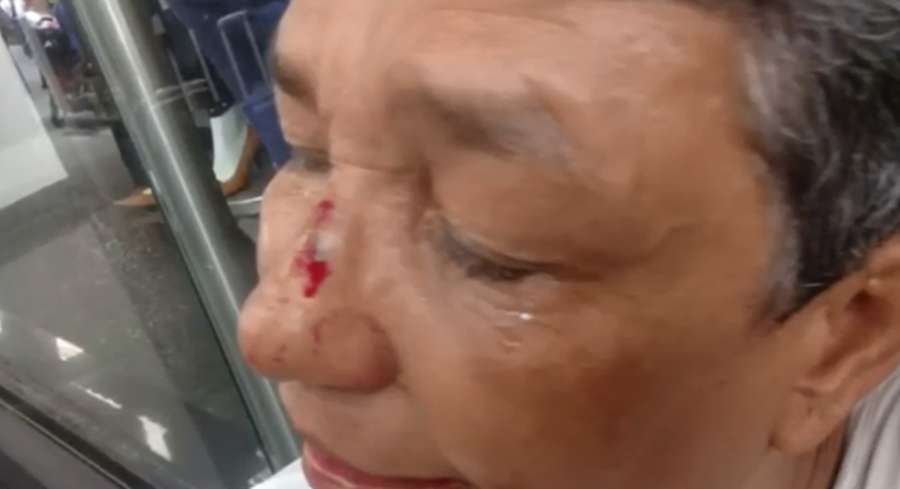 Por 30 mil pesos ‘pagadiario’ golpeó brutalmente a mujer de 60 años