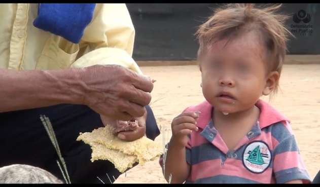 ¡Alerta! aumentan los casos de desnutrición, 3 mil niños afectados en el Atlántico