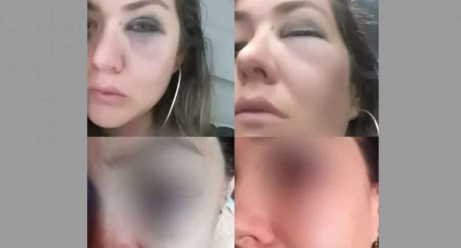 Casi pierde el ojo: monstruosa golpiza le dieron a periodista por denunciar intento de robo