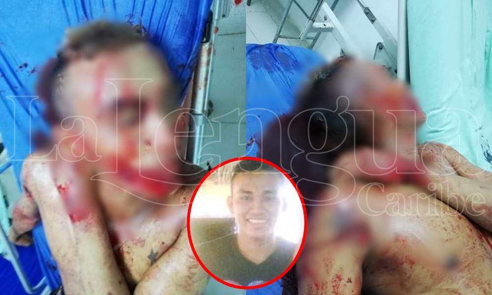 Brutal pelea a machete dejó un muerto y un herido en Ciénaga de Oro