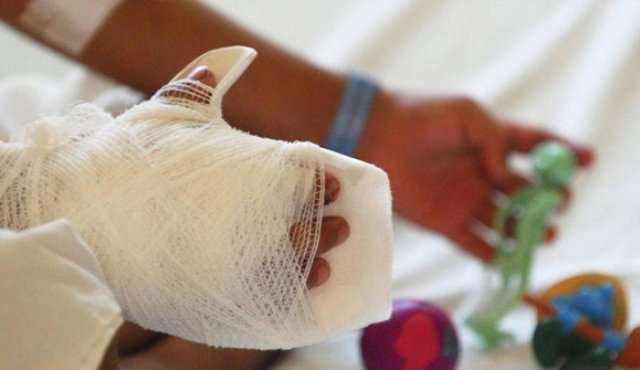 En Córdoba ya se registra el primer caso de menor lesionado con pólvora