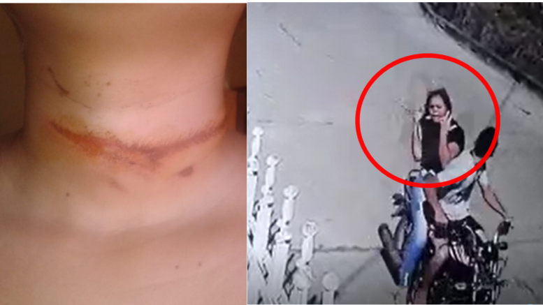 Qué peligro: un cable suelto que se le enredó a una joven en el cuello por poco acaba con su vida en Cereté