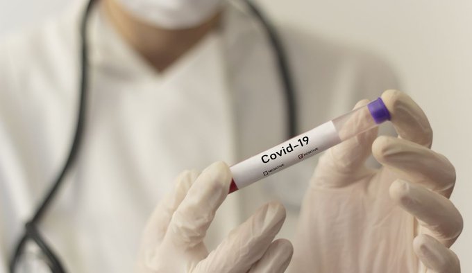 El INS autorizó siete laboratorios para que realicen prueba diagnóstica del coronavirus en Colombia