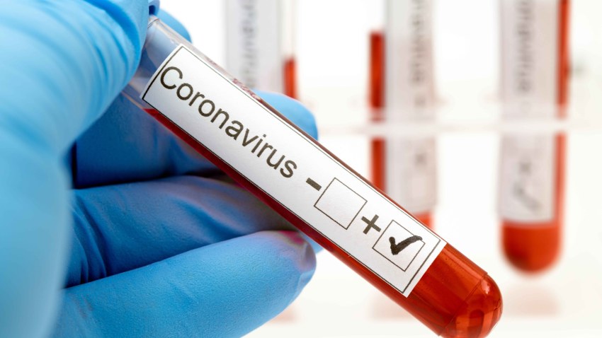 Paciente infectada con coronavirus en Sahagún cumple con todos los protocolos sanitarios y permanece en aislamiento