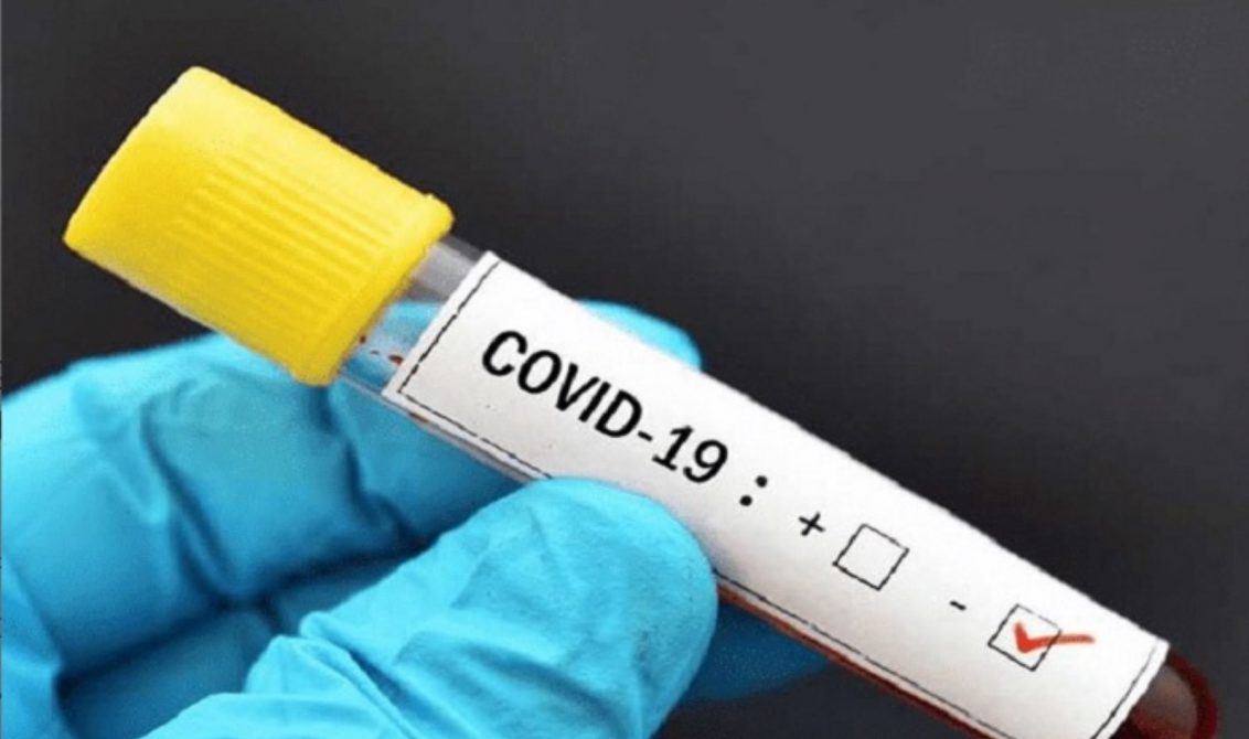 Se reportan 296 nuevos casos de coronavirus en Colombia, ya son 6.507