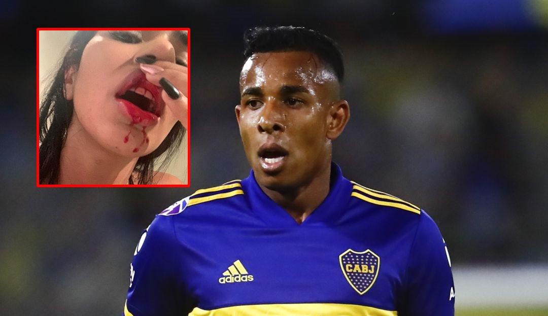Polémica en el fútbol: con fotos y videos, expareja de jugador colombiano lo acusa de agredirla y amenazarla