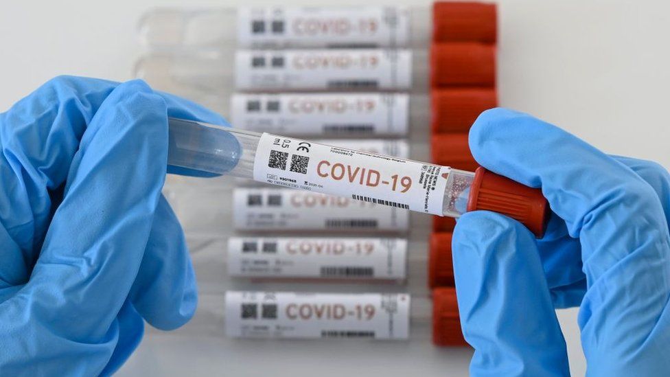 Seis casos nuevos de Covid-19 en Córdoba y ya son 110 los contagiados