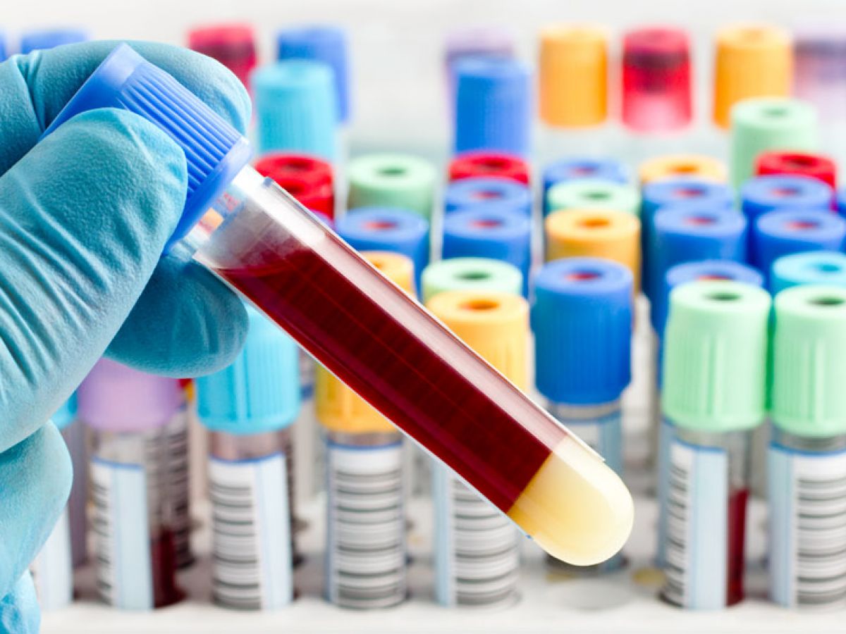 Exámenes de sangre podrían ser cruciales para determinar que pacientes con coronavirus pueden empeorar