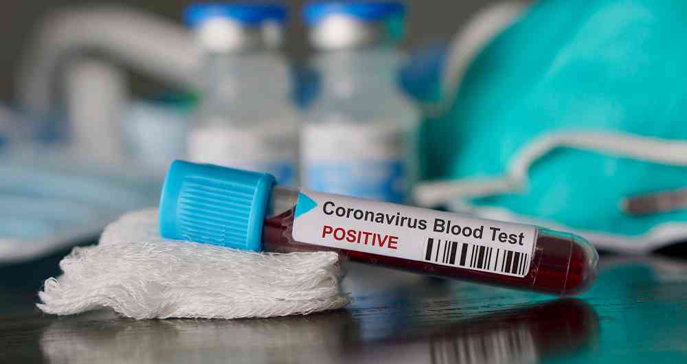 Municipio declarado ‘No Covid-19’ deberá volver a la cuarentena tras detectar primer caso de coronavirus