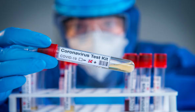 Revelan detalles sobre los dos nuevos casos de coronavirus en Lorica