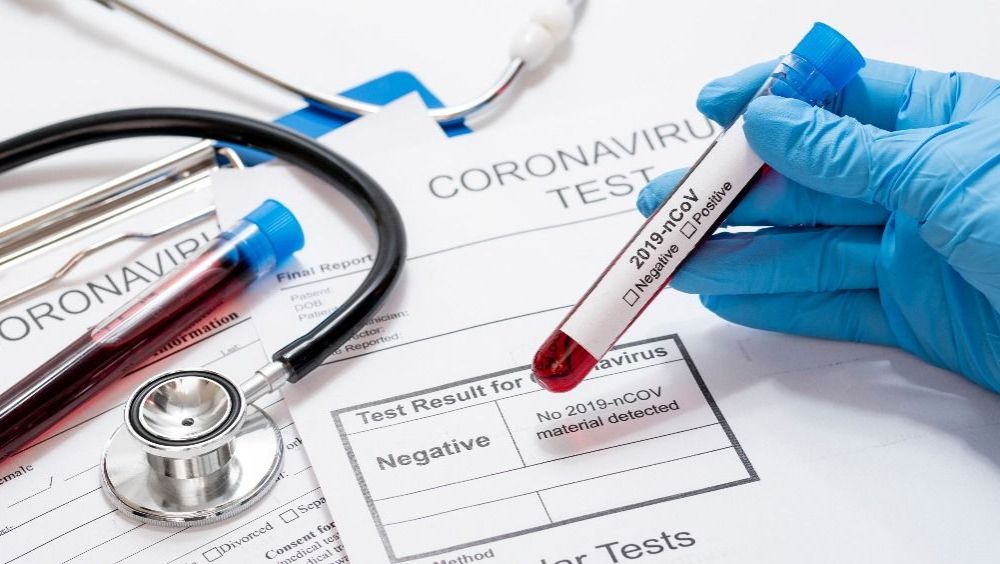 Reportan 34 resultados negativos de Covid-19 en Córdoba