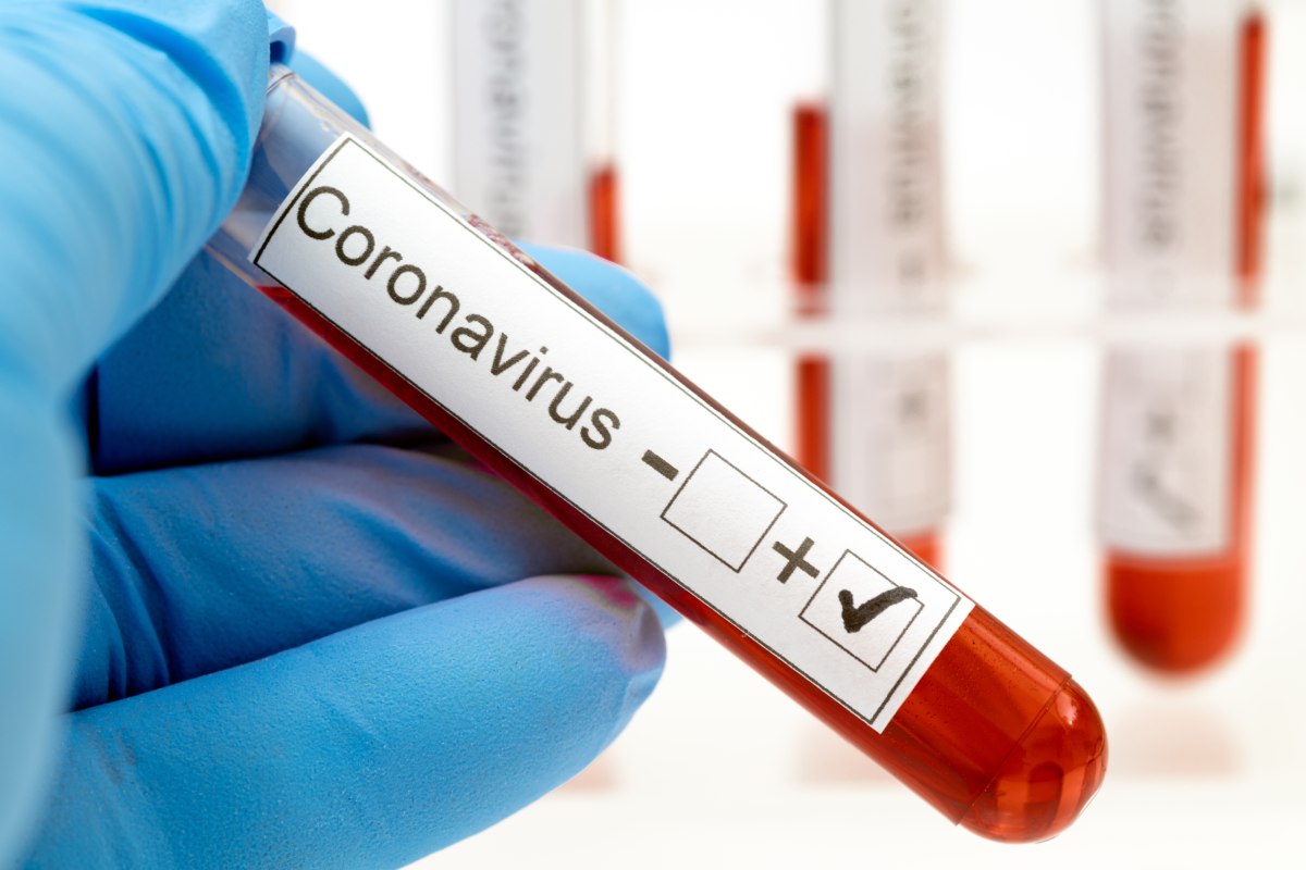 Estos son los detalles de los nuevos cinco casos de coronavirus en Sahagún