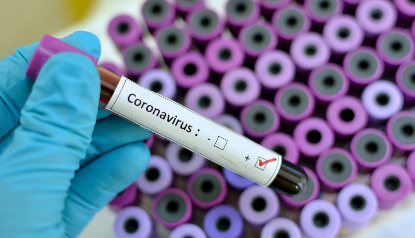 Confirman 37 nuevos casos  de Covid-19 en Córdoba, ya son 644 los contagiados