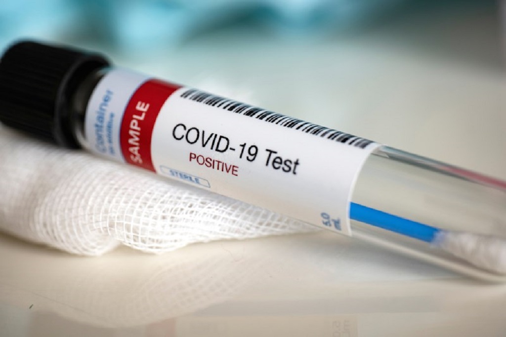 Con 12 nuevos contagios, Montería llegó a 264 casos de Covid-19