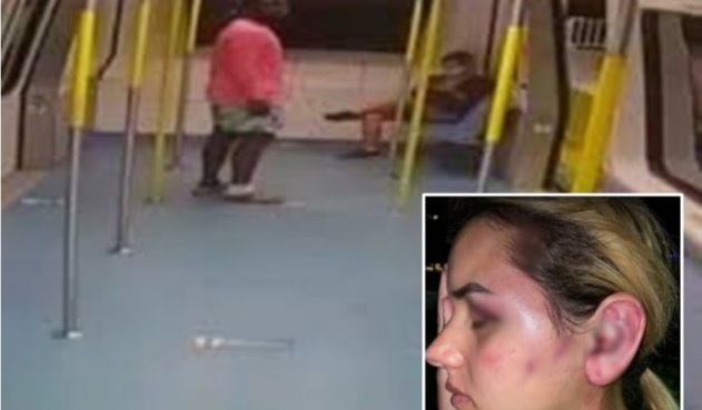 Colombiana recibió tremenda golpiza en pleno metro de Miami