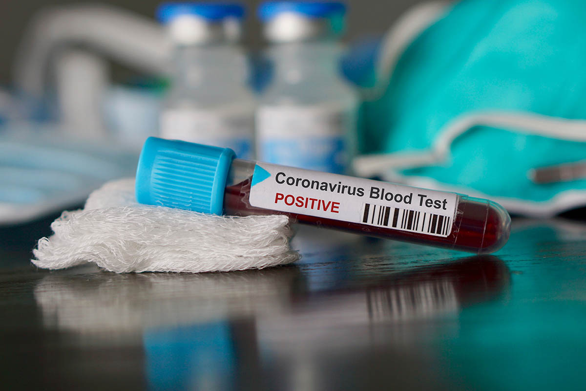 Colombia hoy reporta 6.876 nuevos casos y 216 fallecidos por coronavirus
