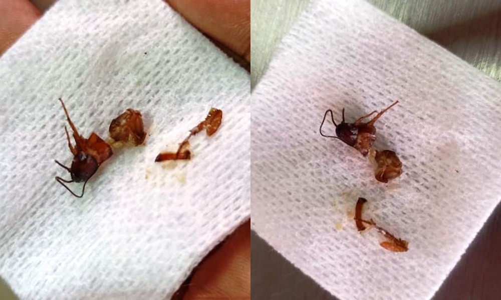 Qué horror, a joven monteriana se le metió una cucaracha en el oído mientras dormía