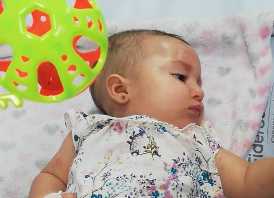 El colmo: EPS Sura le niega cita prioritaria a bebé de seis meses diagnosticada con mastocitosis