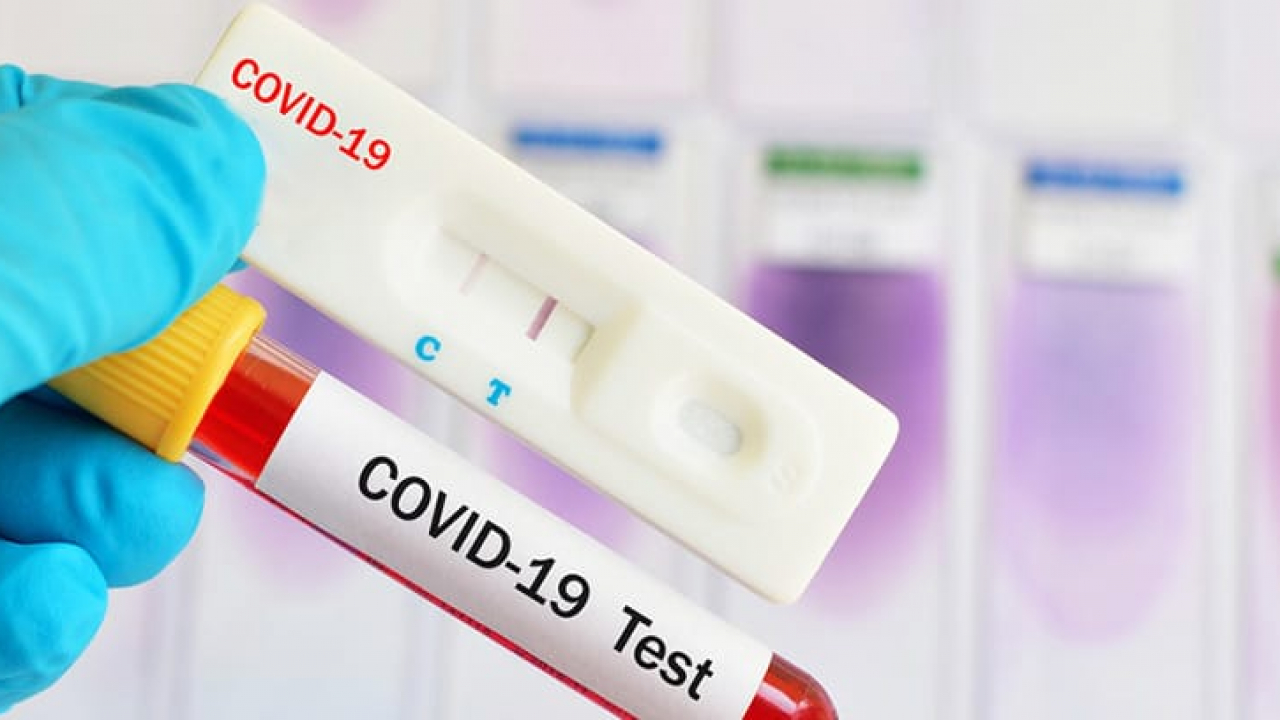 Covid-19 en Córdoba: este viernes reportan 93 nuevos casos y 2 decesos