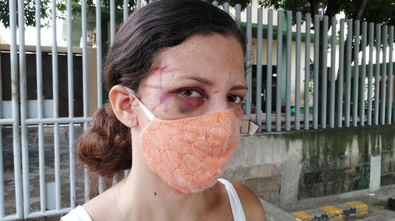 Mujer recibió violenta paliza por parte de su cuñada y suegra
