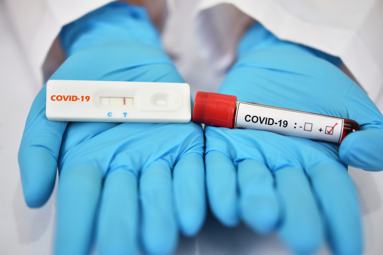 Covid-19 en Colombia: hay 106.631 casos activos