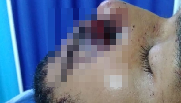 Le pegaron un ‘garrotazo’ en la cara y sufrió graves heridas