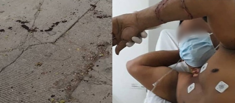 Dos sujetos se dieron machete por 10 mil pesos en Sahagún