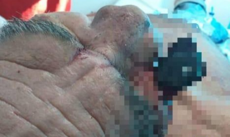 Trabajador mordió la mano que le dio de comer y apuñaló a su patrón en Tierralta