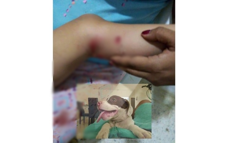 Niño fue atacado por un perro pitbull en Lorica