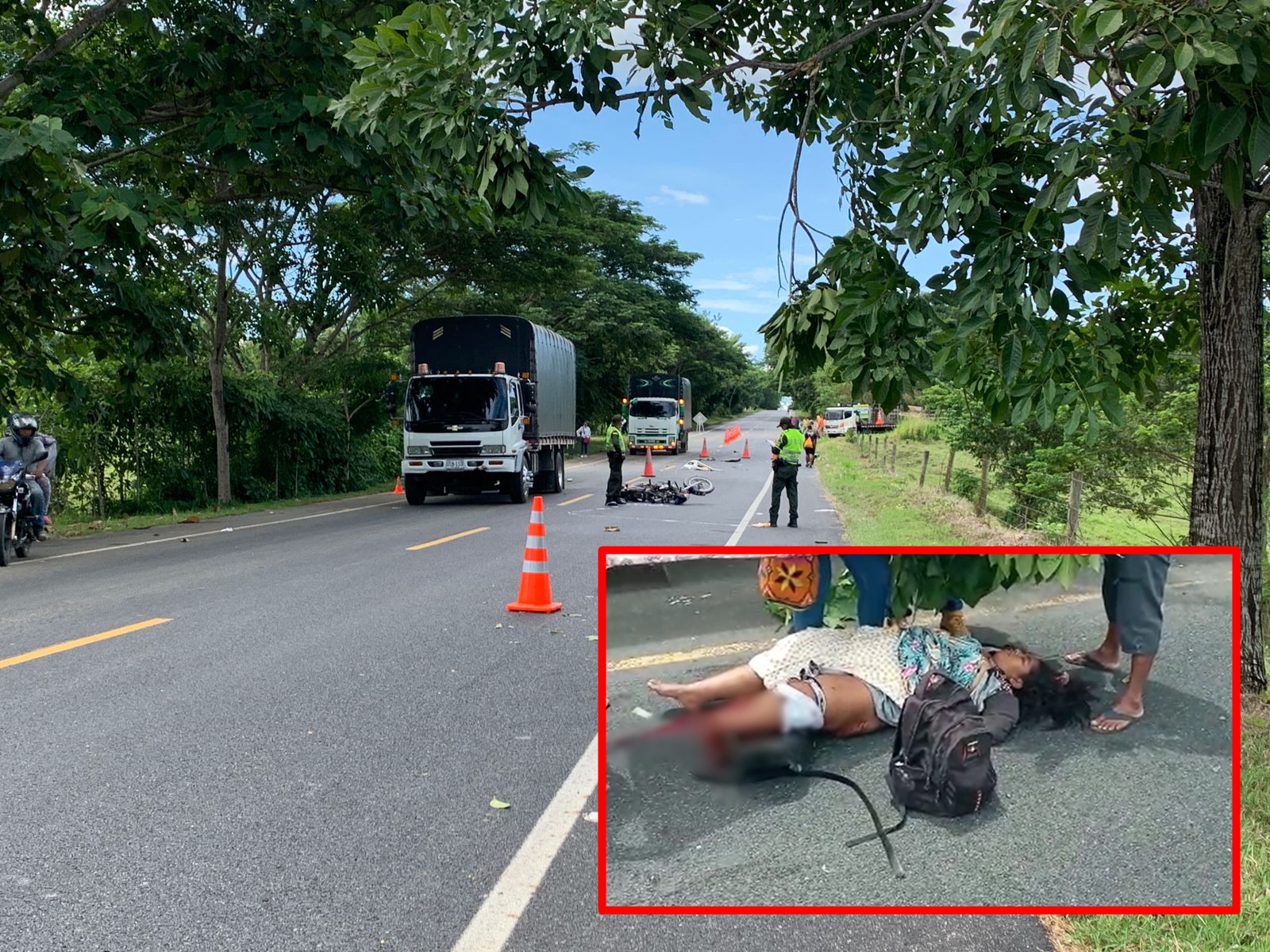 Terrible accidente en la vía Montería – Planeta Rica, mujer sufrió amputación de un pie tras el impacto