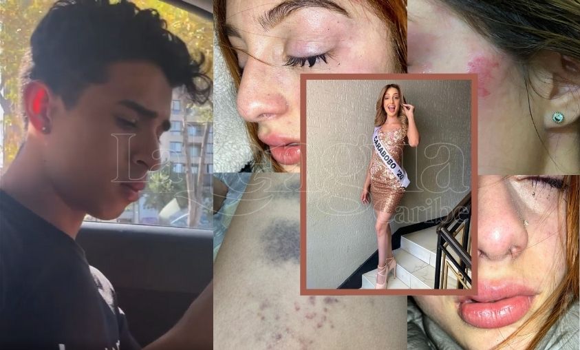 Con fotos y videos, Miss Venezuela en Chile denuncia brutal agresión de su expareja