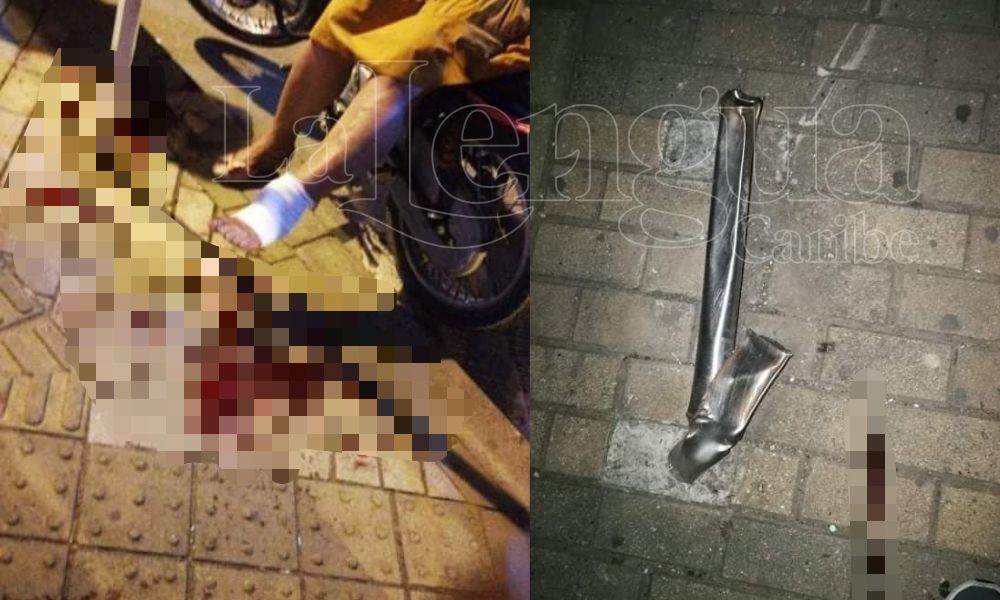 ¿Quién responde? Mujer se cortó el pie tras tropezar con un tubo de acero en un andén en Montería