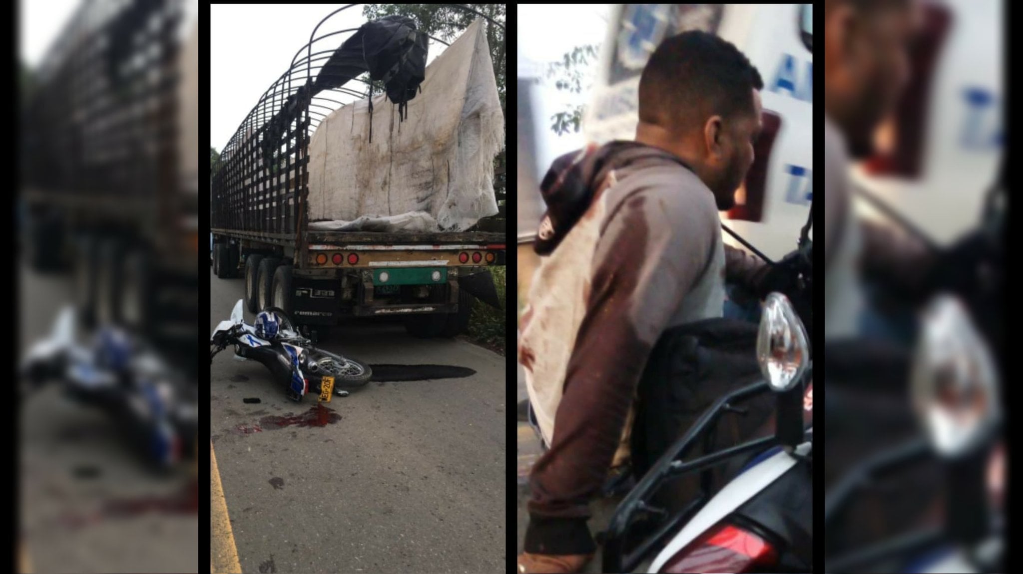 Motociclista resultó herido tras chocar contra un camión en la vía Tierralta – Montería