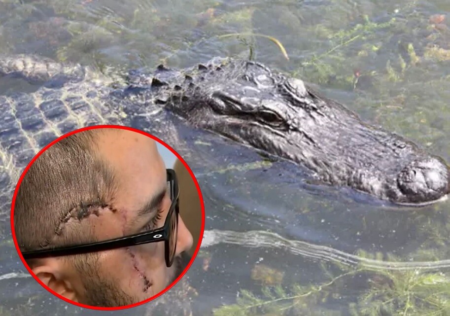 Colombiano sobrevivió a ataque de un caimán en Florida, Estados Unidos  