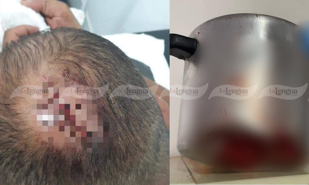 Mujer golpeó en la cabeza a su esposo con una olla de presión por ‘infiel’