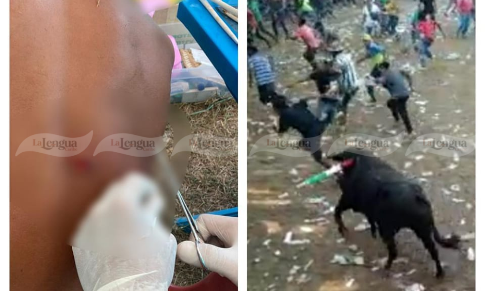 Los dos jóvenes que fueron heridos por un toro en Tierralta se recuperan en una clínica de Montería