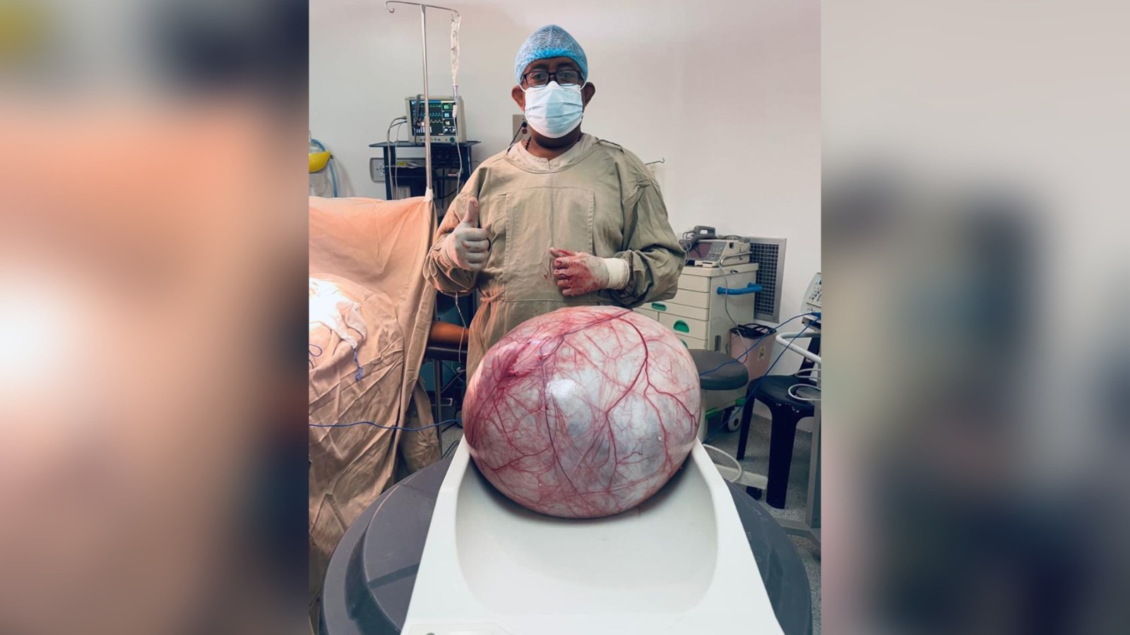 Impresionante, le extirpan tumor de 12 kilogramos a una mujer wayuu