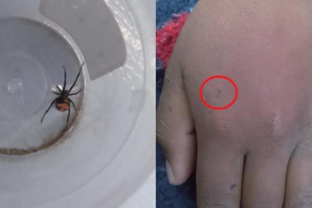 ¡Qué peligro! Niño se hizo picar por una araña para convertirse en Spider-Man