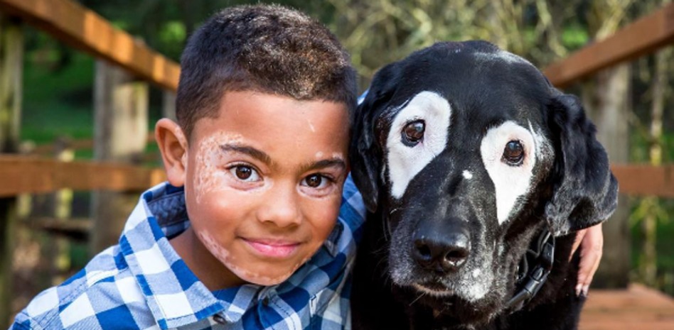 Carter, un niño con vitíligo que superó la depresión gracias a un perrito igual a él