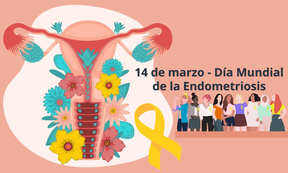 La detección temprana de la endometriosis facilita un mejor tratamiento